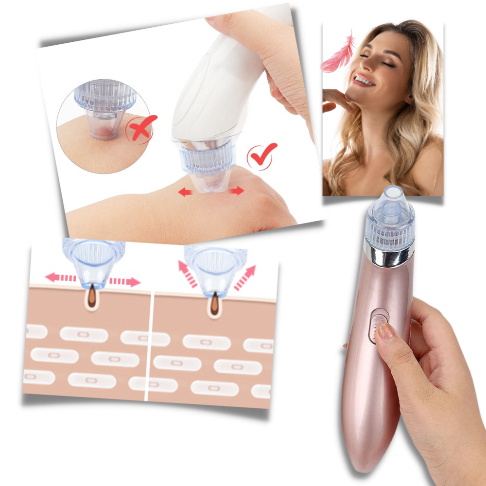 Facial Blackhead Remover Set - Ozerty